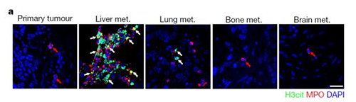 转入小鼠模型得到相同的试验结果，且在转移发生前NET已在肝脏聚积。