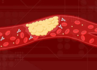 【Science速递】攻克COVID-19里程碑：已确定血凝块形成原因！