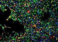 世界首创：药物将干细胞引导至受损部位，提高其愈合能力！