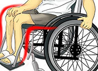 Nature：还瘫痪患者一个自由身的日子不远了