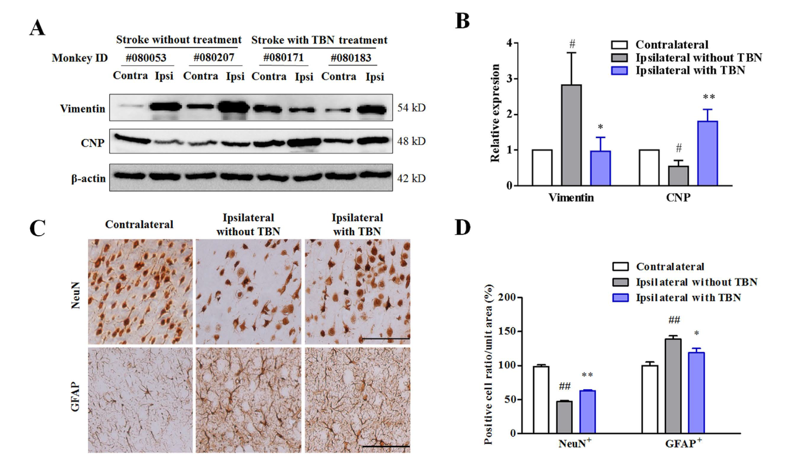 TBN是一种治疗缺血性卒中的新型临床候选药物，本研究中TBN通过不朽情缘mg官网合成